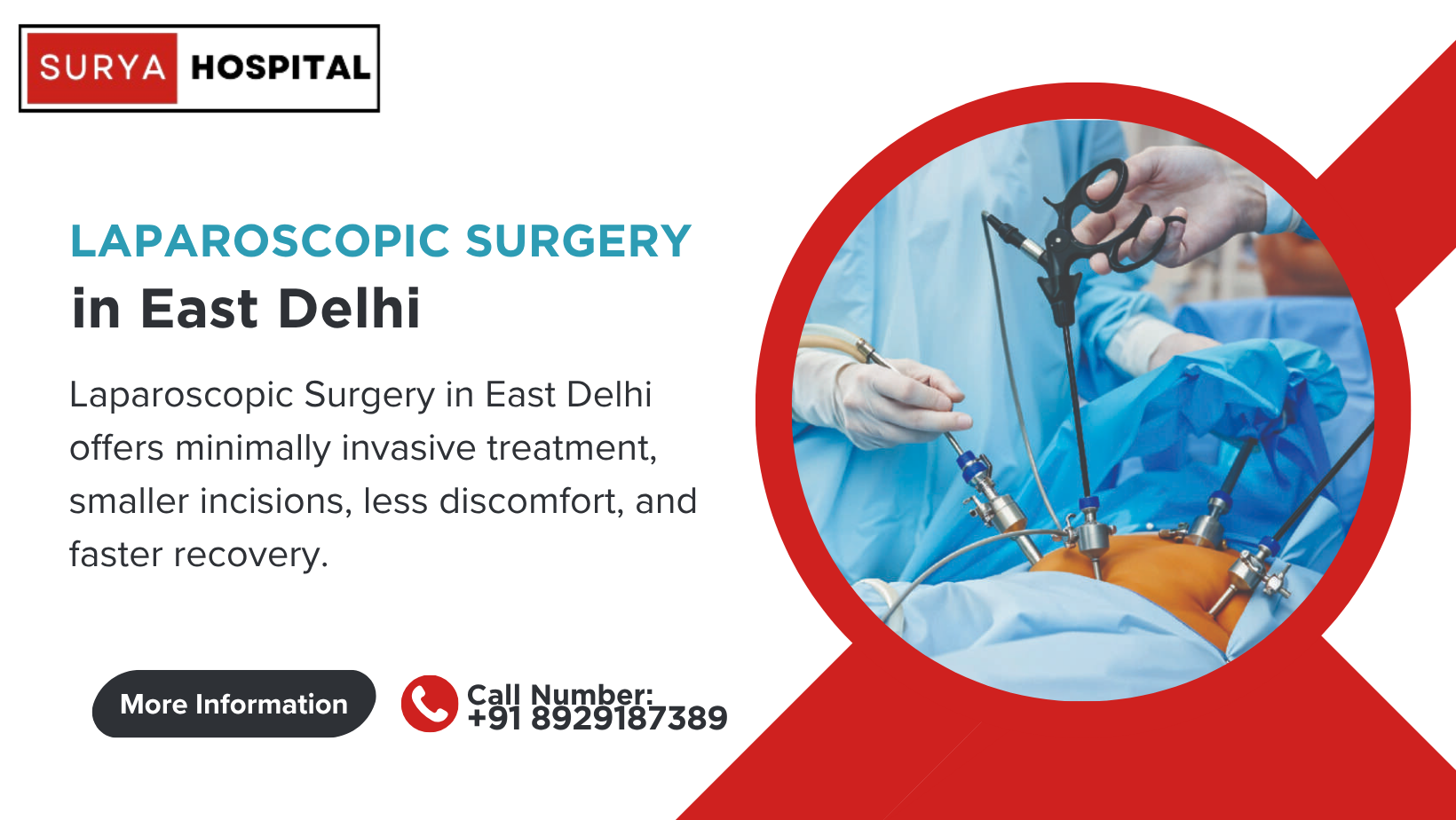 Laparoscopic Surgery in East Delhi for Safe Treatment